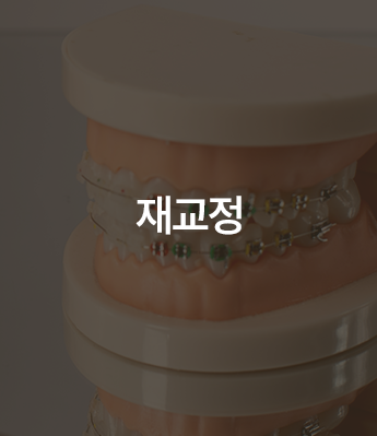 재교정